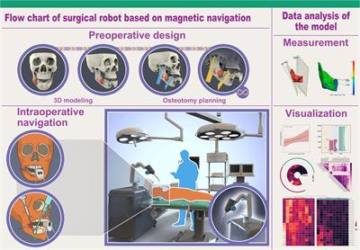Intelligent electromagnetic navigation system for robot-assisted intraoral osteotomy in mandibular tumor resection: a model experiment